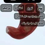 علائم زخم معده + فیلم