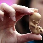 نگهداری حیوانات خانگی در بارداری، عامل افزایش ناهنجاری جنین