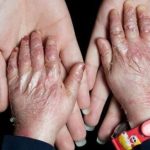 زخم بی‌توجهی بر تن پروانه‌ها