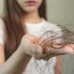 حمله سیستم ایمنی به فولیکول‌های مو