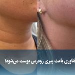 ویدیو/ وقتی فناوری باعث پیری زودرس پوست می‌شود!