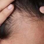 عادت‌های ساده برای جلوگیری از ریزش مو