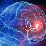 آلزایمر همیشه ارثی نیست؛ مراقبت‌های روزمره نقش کلیدی دارند