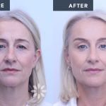 بهترین متخصص جراحی پلک چه ویژگی هایی دارد + معرفی 10 متخصص برتر