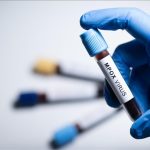 شناسایی سویه جدید «ام پاکس» در انگلیس